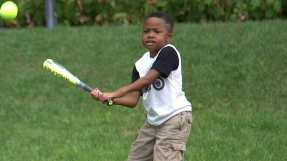 Double hand transplant boy plays baseball